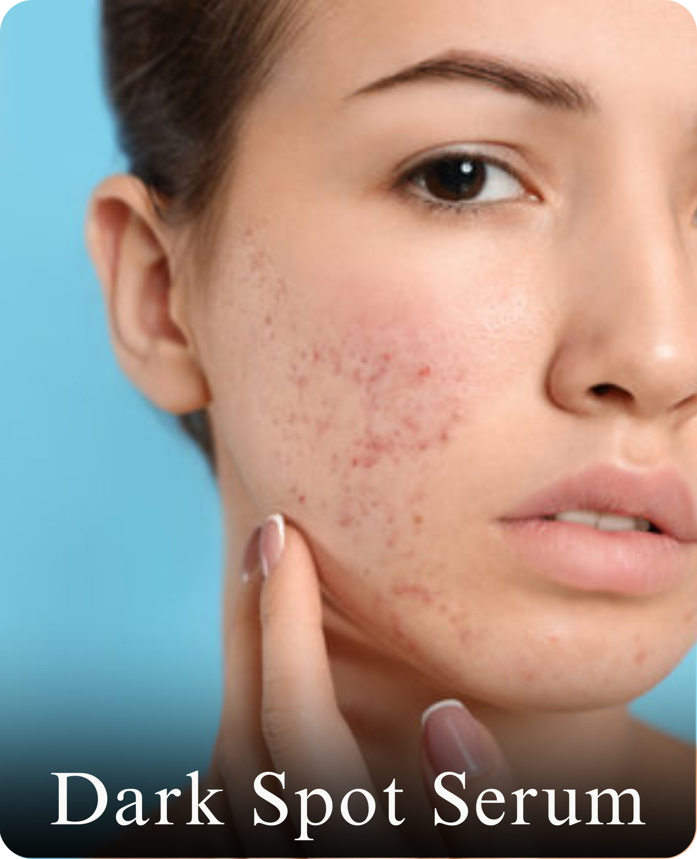 Dark Spot Serum