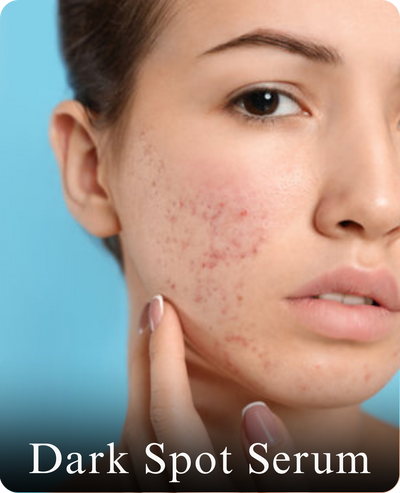 Dark Spot Serum
